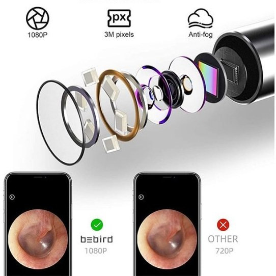 گوش پاک کن هوشمند شیائومی مدل Bebird R1